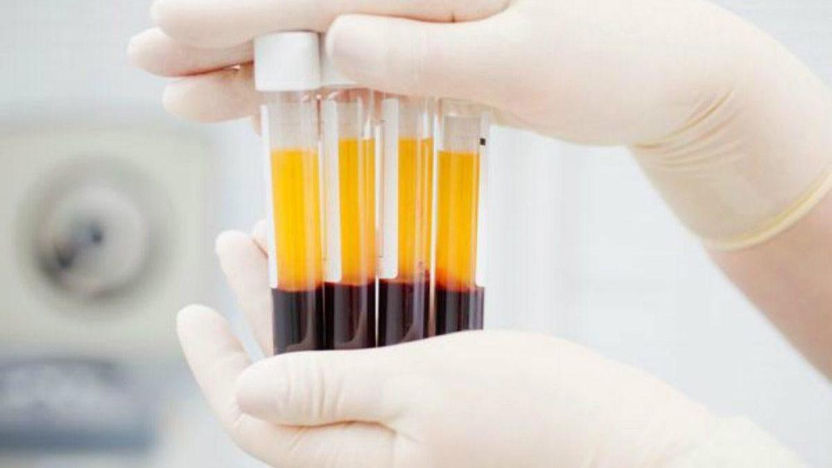 Estados Unidos aprueba el tratamiento contra el coronavirus basado en transfusiones de plasma