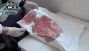 Desmantelado un quirófano clandestino de cirugía estética: aumentos de pecho y liposucciones en condiciones insalubres