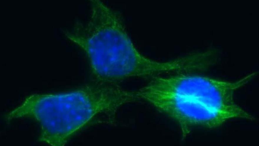Células de cáncer de mama derivadas de un tumor de ratón.