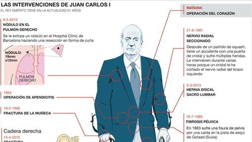 El rey Juan Carlos será operado del corazón mañana en Madrid