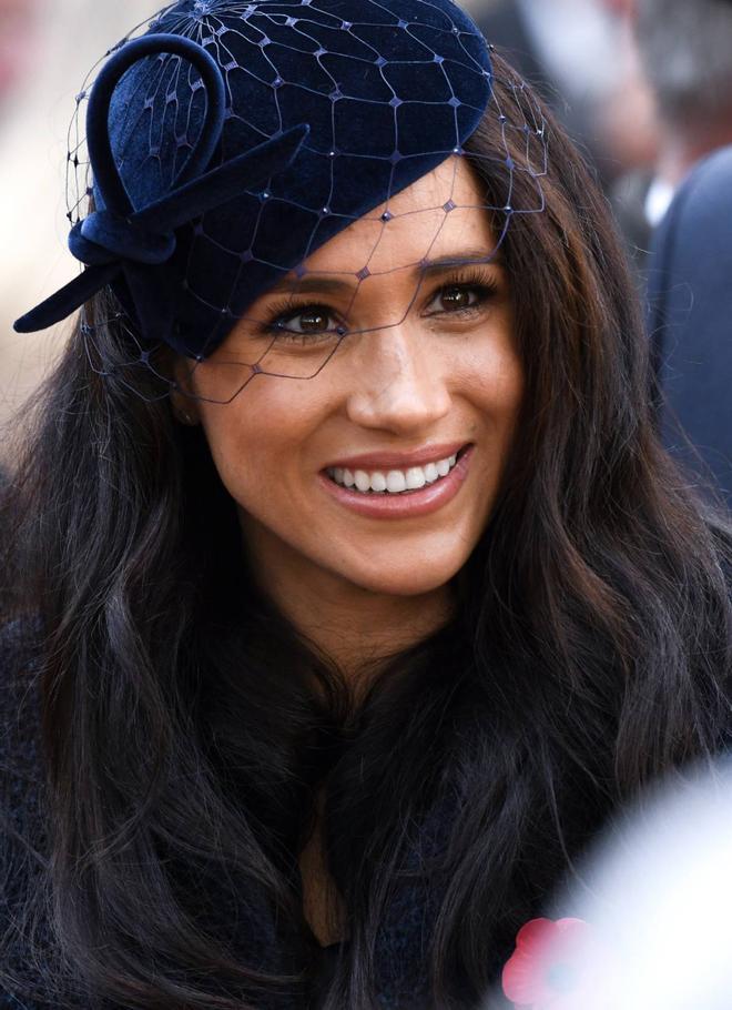 Meghan Markle con pecas