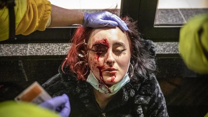 Una imagen de la mujer herida en rl ojo durante los disturbios del martes en Barcelona.