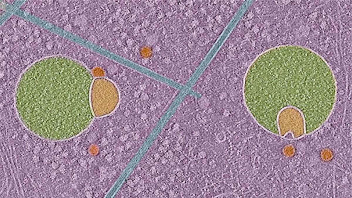 Las estructuras verdes y naranjas de esta imagen son hemifusomas, orgánulos recién descubiertos que pueden representar una vía de reciclaje no identificada hasta hoy en las células humanas.