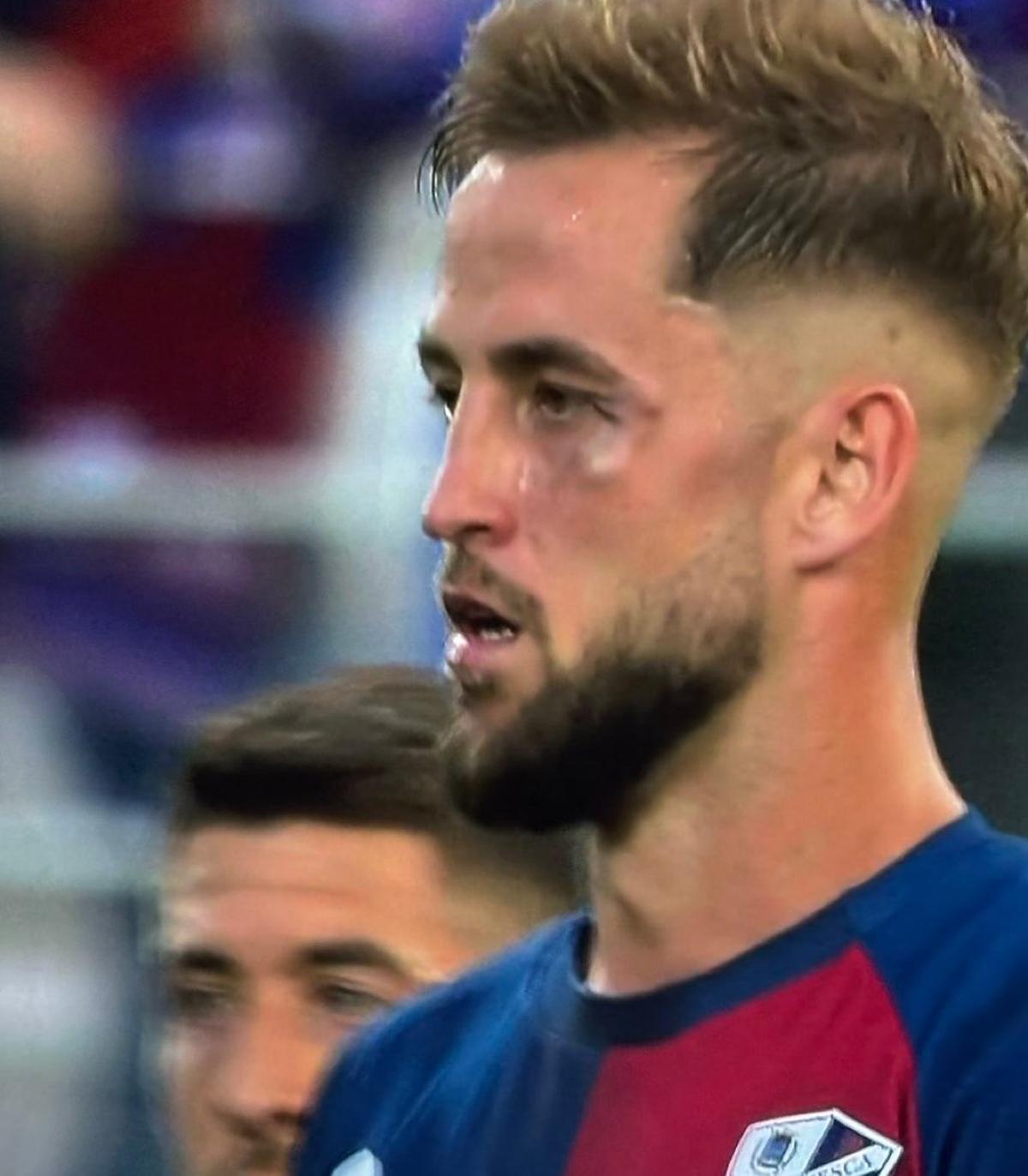La cara de Pulido