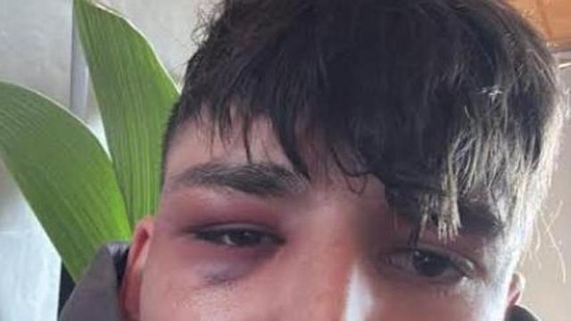 Pacal Kaiser, árbitro alemán agredido por su condición homsexual.