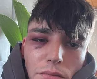 El árbitro alemán que pidió matrimonio a su novio en un partido, objeto de una agresión homófoba en su casa