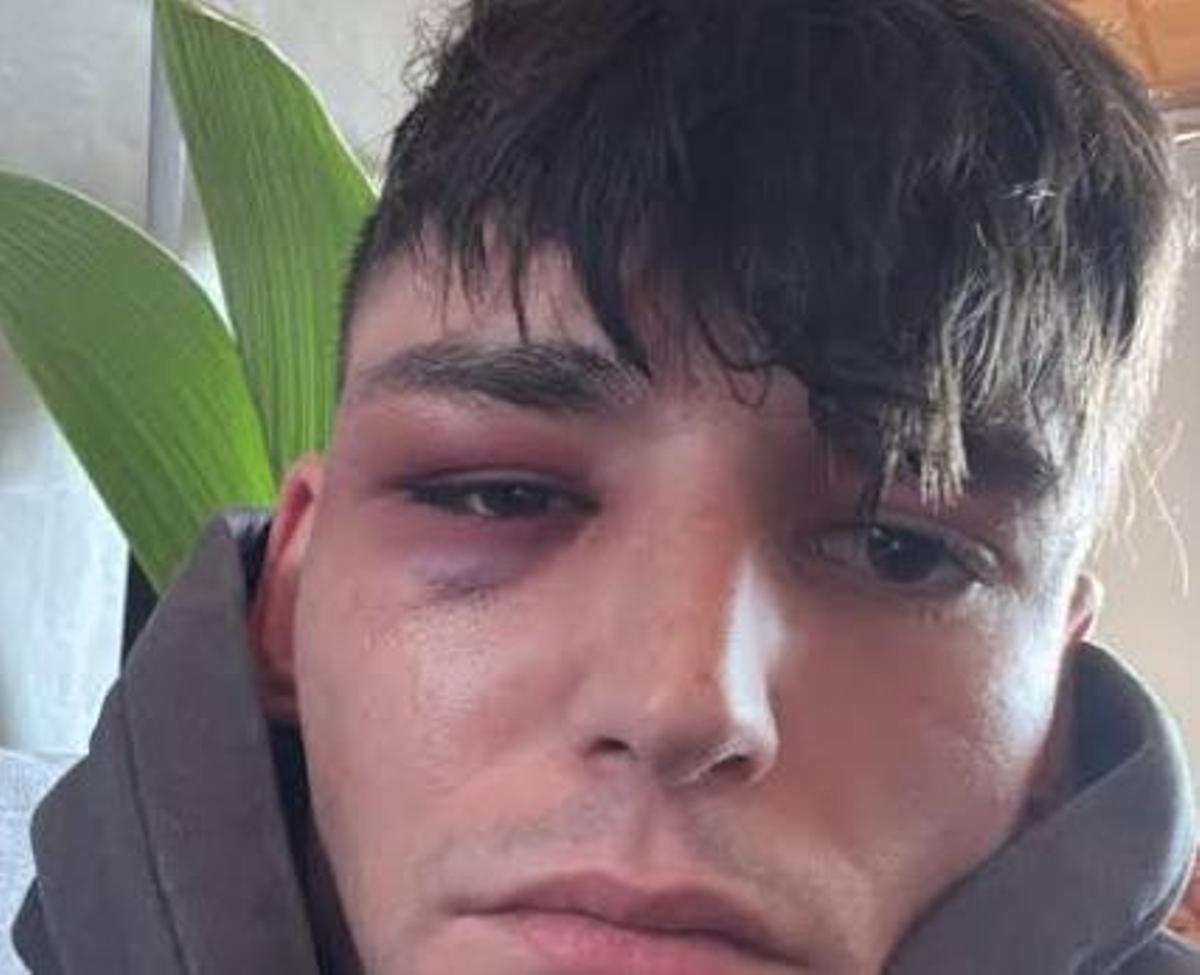 Pacal Kaiser, árbitro alemán agredido por su condición homsexual.