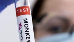 Un test de la viruela del mono