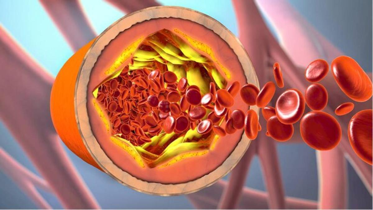 ¿Cómo funcionan el colesterol bueno y el colesterol malo?