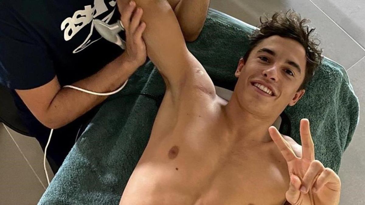 Marc Márquez, en una de las últimas fotos que ha difundido recuperándose.