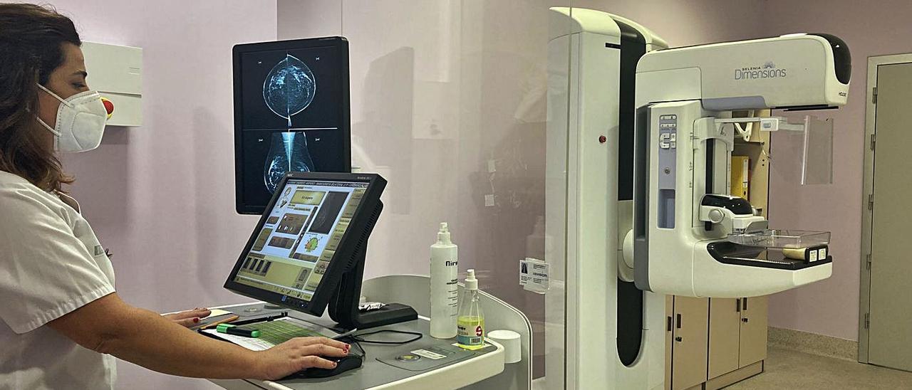Una profesional observa la imagen tomada a través de una mamografía. | LEVANTE-EMV