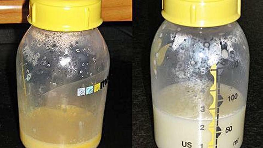 L&#039;hospital d&#039;Olot descobreix com substituir la llet artificial després del part