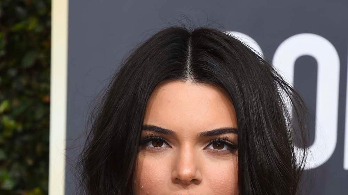Kendall Jenner, acneica y orgullosa