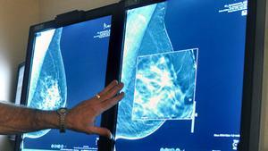 Un metge observa la mamografia d’una pacient.