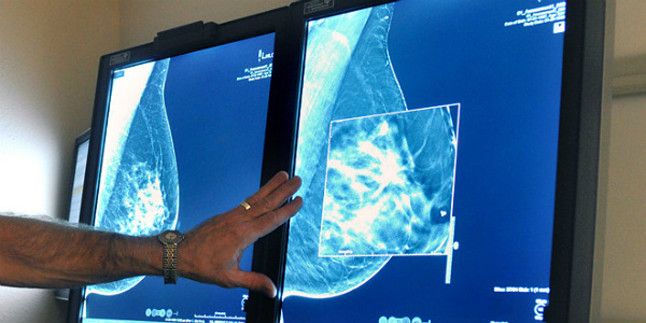 Un doctor observa la mamografía de una paciente.