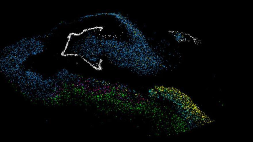 La depresión detiene la formación de nuevas neuronas en el cerebro