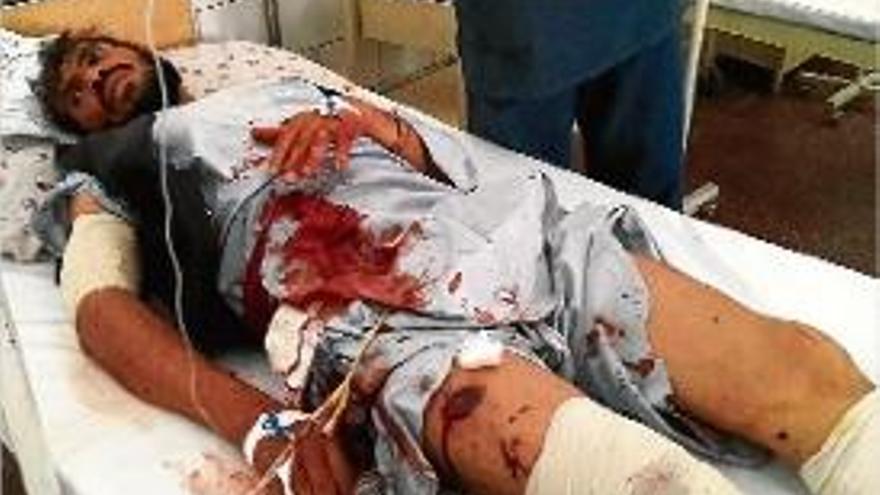 Un dels ferits en el brutal atemptat de Faryab.