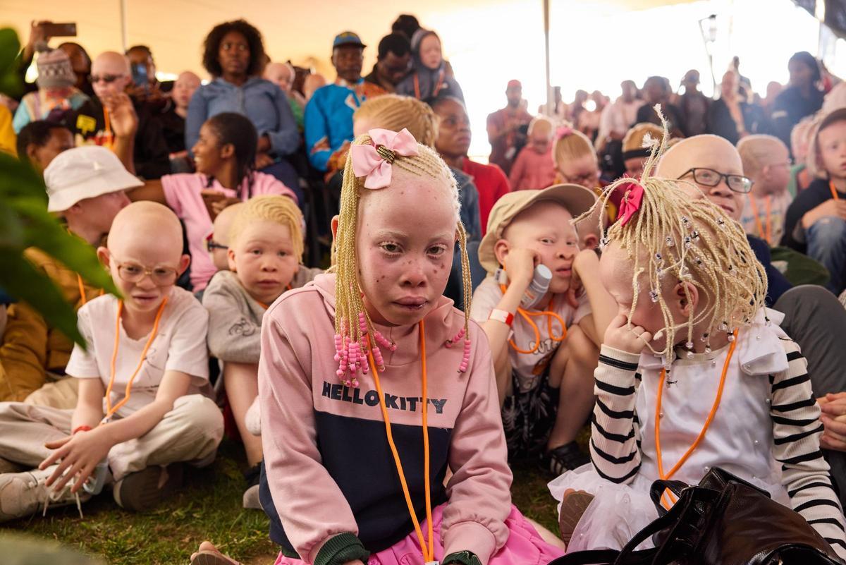Un proyecto de la USC con albinos en Mozambique, candidato a los XIII Premios al Voluntariado Universitario de Fundación Mutua Madrileña