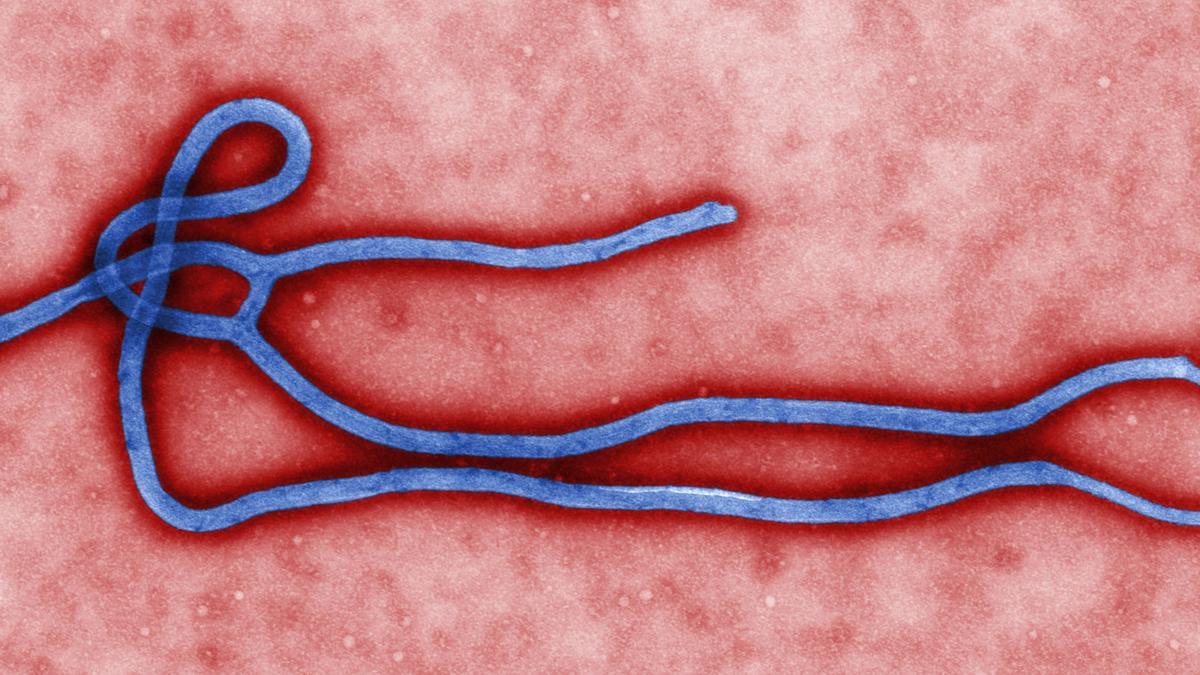 Virión (partícula vírica morfológicamente completa e infecciosa) del virus del Ébola