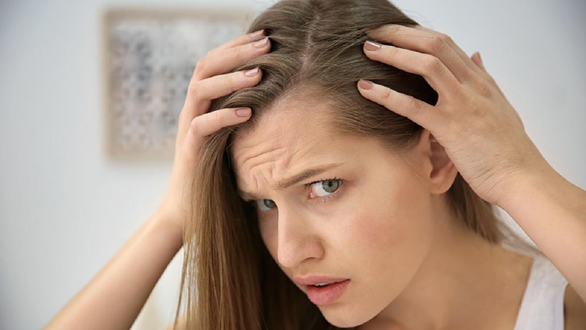 Entre un 5 y un 10% de las mujeres sufren alopecia androgénica ¿Se puede tratar?
