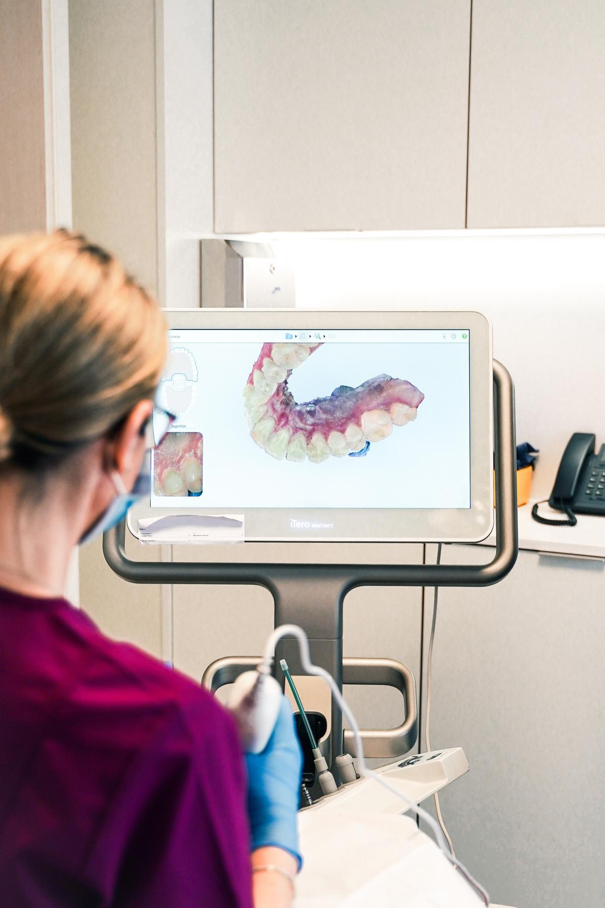 A partir del  estudio ortodóntico mediante radiografías 3D, se diseñan las férulas o alineadores invisibles adaptados a la dentadura.