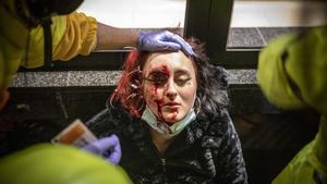 La mujer herida en un ojo presuntamente por una bala de foam de los Mossos en una protesta contra el encarcelamiento de Pablo Hasél, en Barcelona.