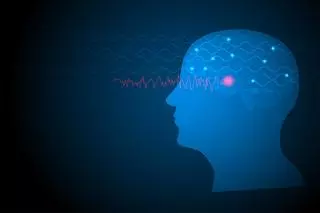 Epilepsia: síntomas y causas
