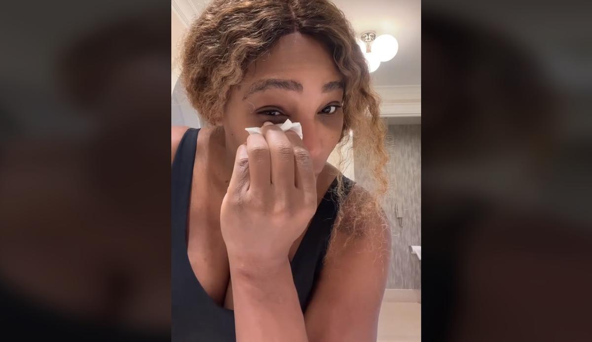 La tenista Serena Williams se plica unas gotas de leche materna bajo los ojos.