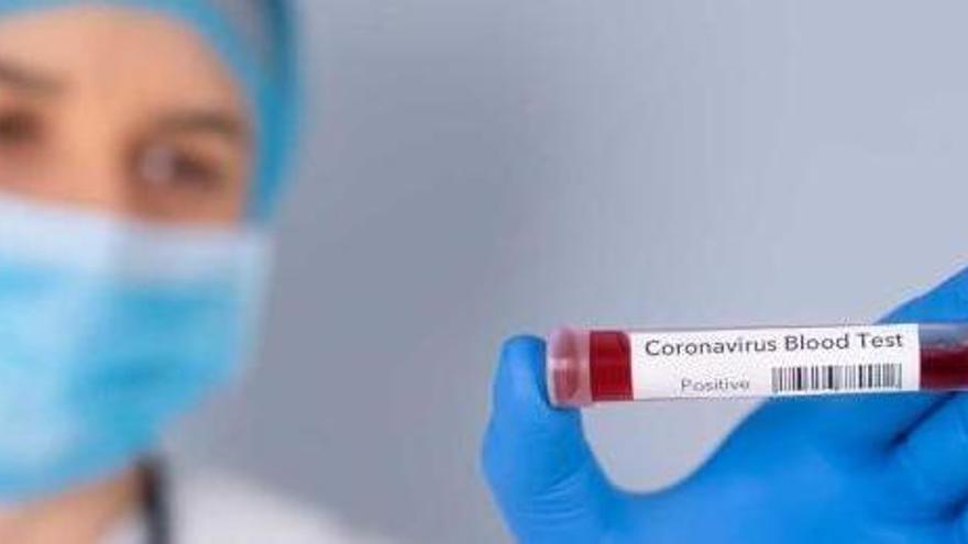 Baleares registra 246 enfermos de coronavirus, 43 más que ayer