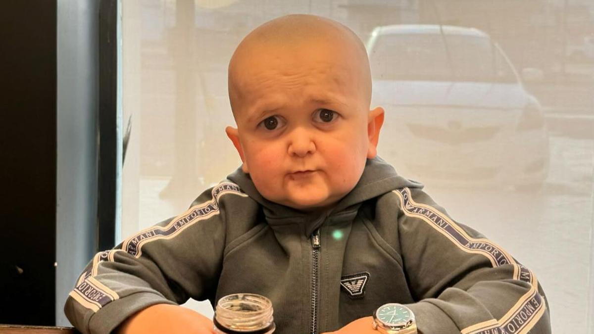 HASBULLA | Hasbulla arrasa en redes por su cambio físico: ¿qué se ha