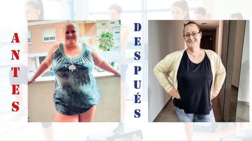 Ana, operada de obesidad mórbida: &quot;He perdido ocho tallas. Pesaba 120 kg y usaba un andador&quot;