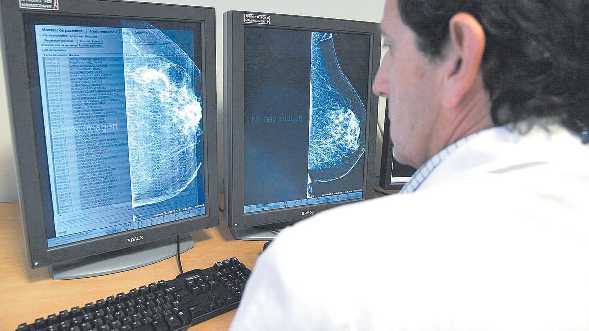 Un oncólogo mira una mamografía.