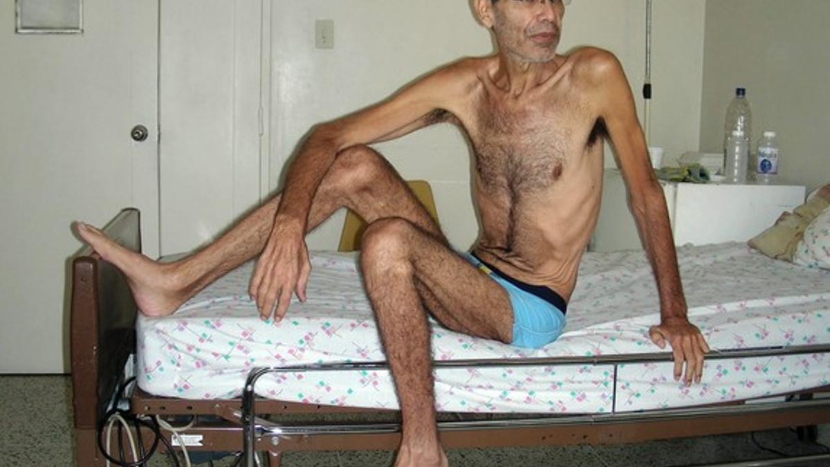 El productor agrícola venezolano, Franklin Brito, durante su huelga de hambre en el Hospital Militar de Caracas.
