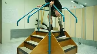 Cuatro amputaciones a la semana: Galicia, segunda comunidad con mayor tasa del país