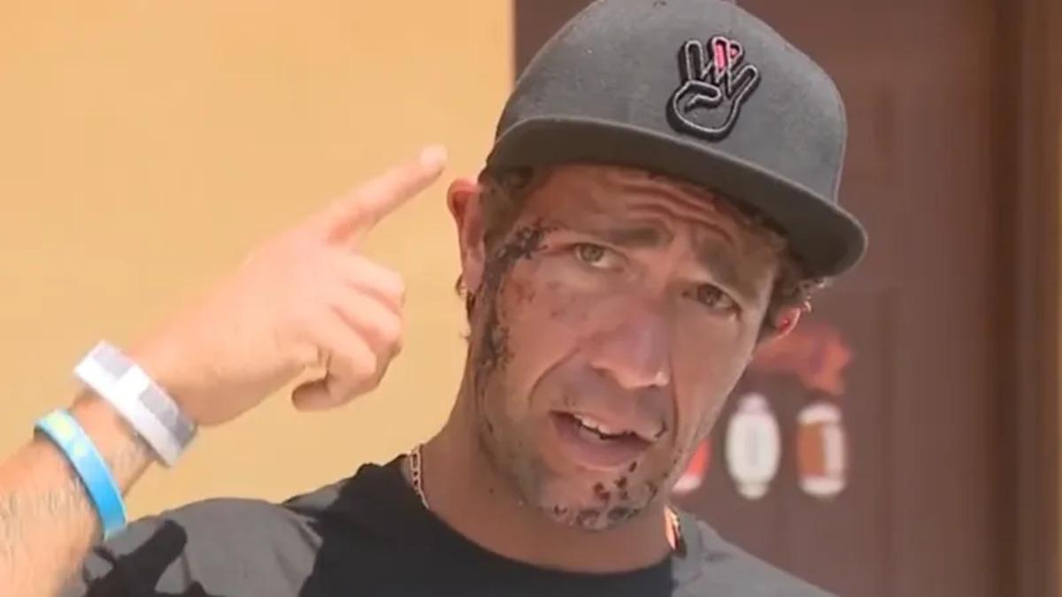 El relato de un surfista que sobrevivió a la mordedura de un tiburón en su cara