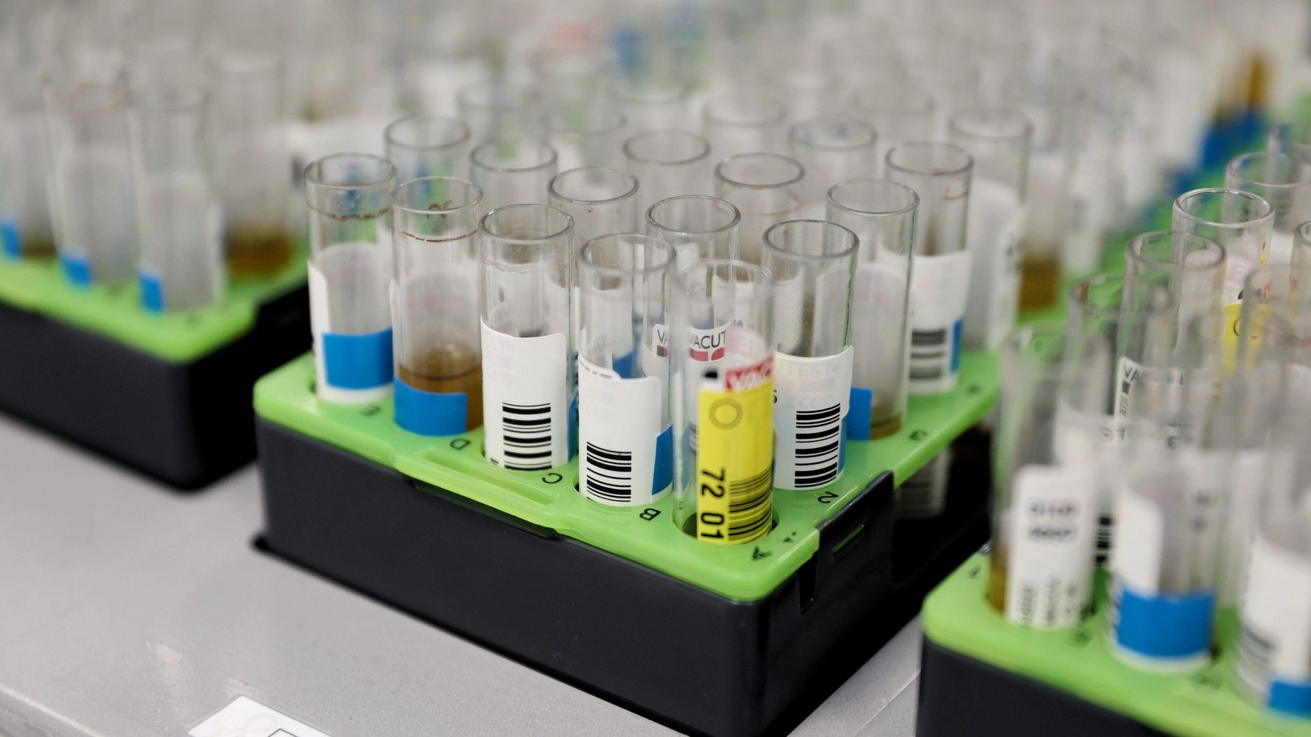 Probetas de pruebas PCR en el Laboratorio de Microbiología del Hospital Gregorio Marañón, el 31 de mayo de 2022