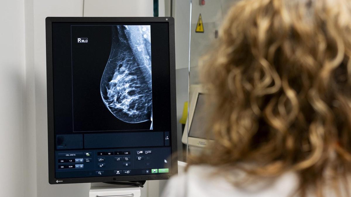 Una tècnica especialista en radiodiagnòstic realitza una mamografia