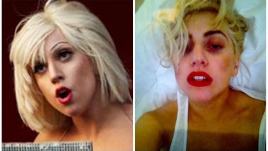 Una imagen del antes y el ahora de Lady Gaga.