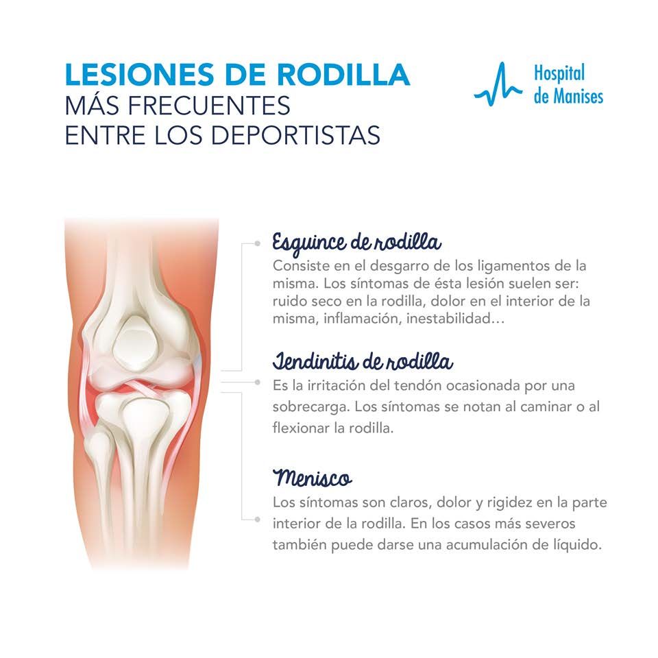 Tipos de lesiones de rodilla más habituales entre los pacientes.