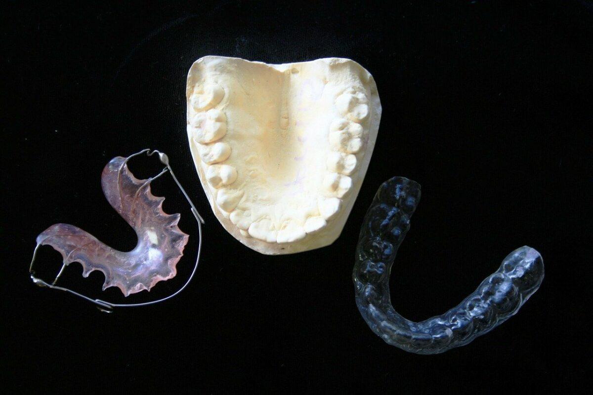 Los odontólogos alertan sobre el uso de alineadores dentales sin prescripción