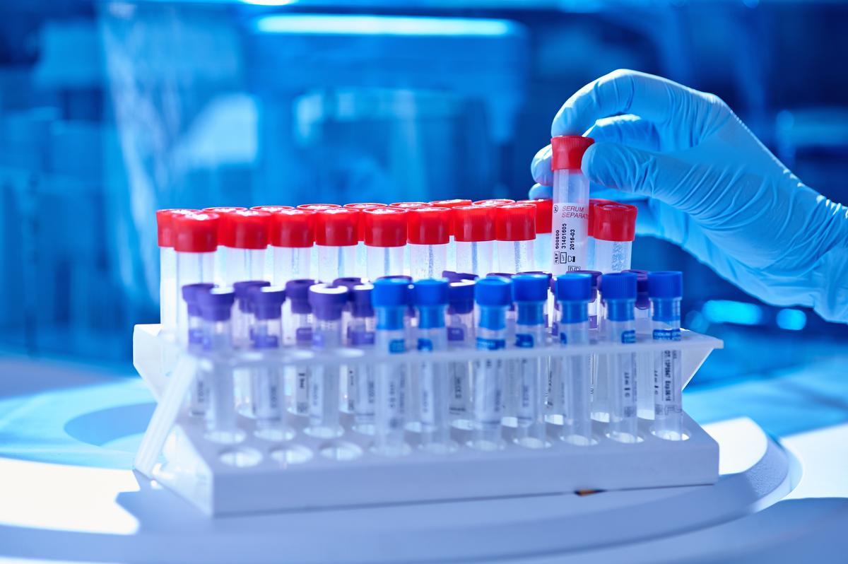 Muestras para la realización de pruebas PCR.