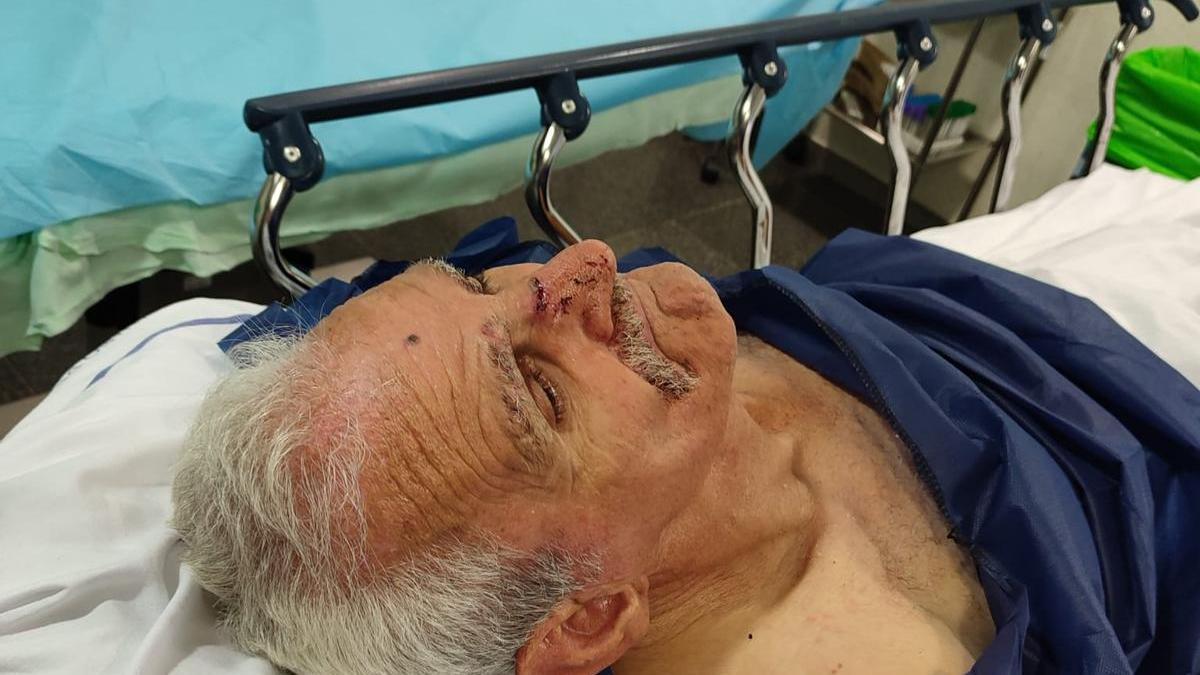 Una imagen de Tomás en el Hospital Insular donde se aprecia la fractura en la nariz