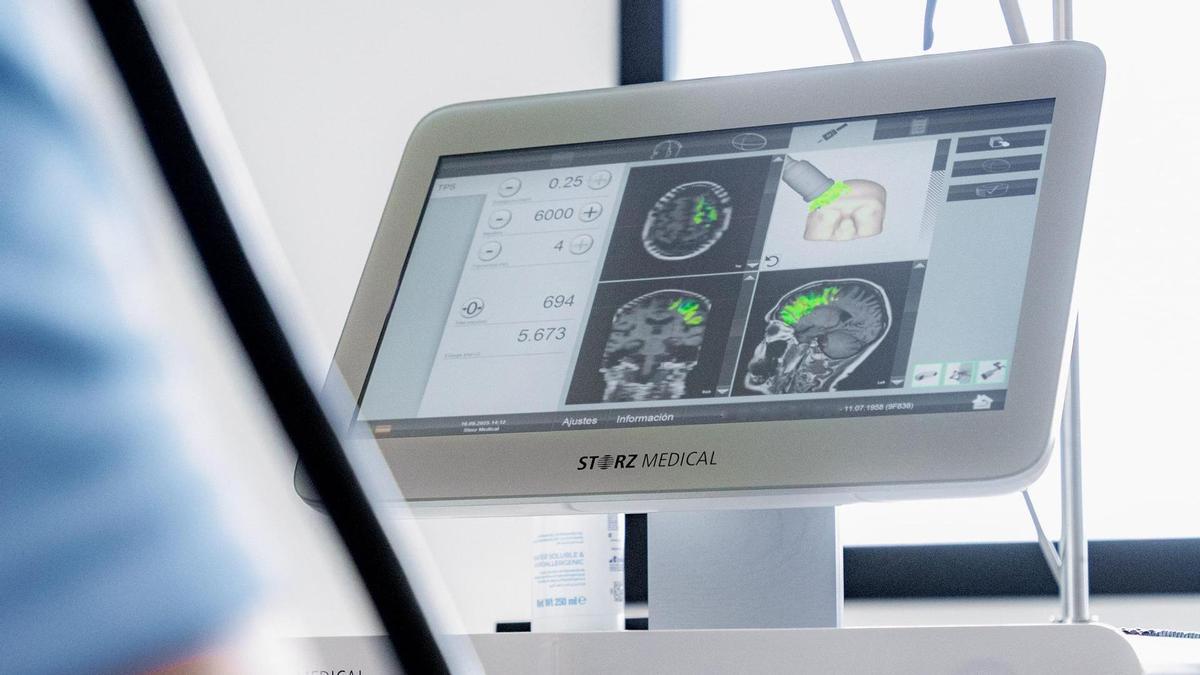 Neurolith, una esperanza tecnológica frente al Alzheimer