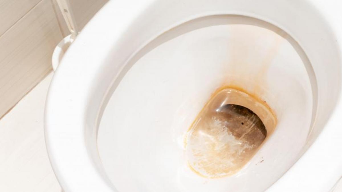 Conviene mantener el baño limpìo para evitar la acumulación de suciedad