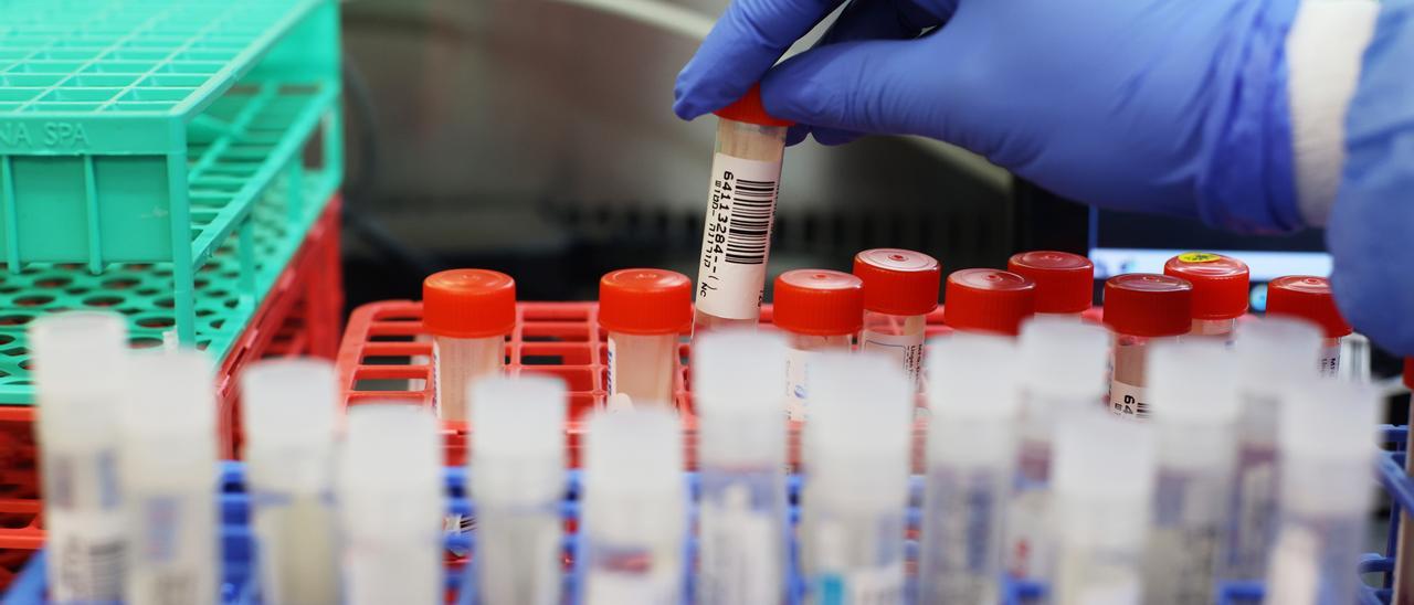 Un fallecido y 280 nuevos contagios Covid en Canarias en las últimas horas