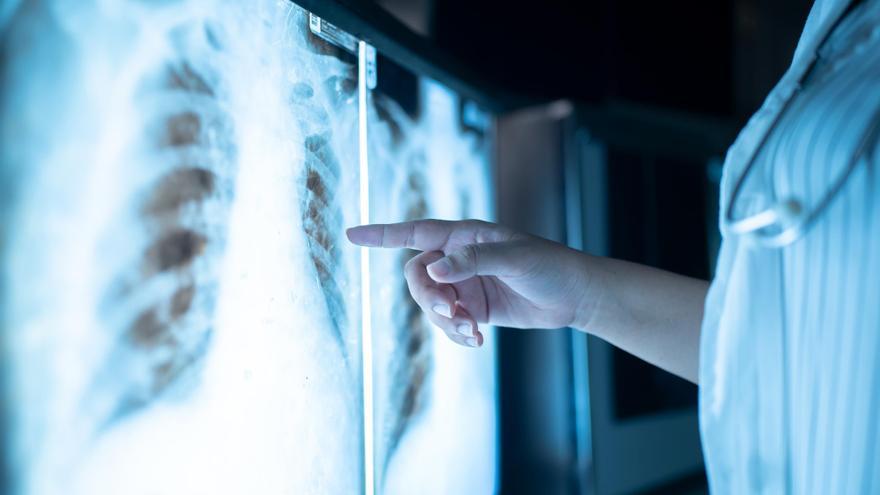 Síndrome del pulmón blanco: la peligrosa enfermedad que ya se ha convertido en epidemia