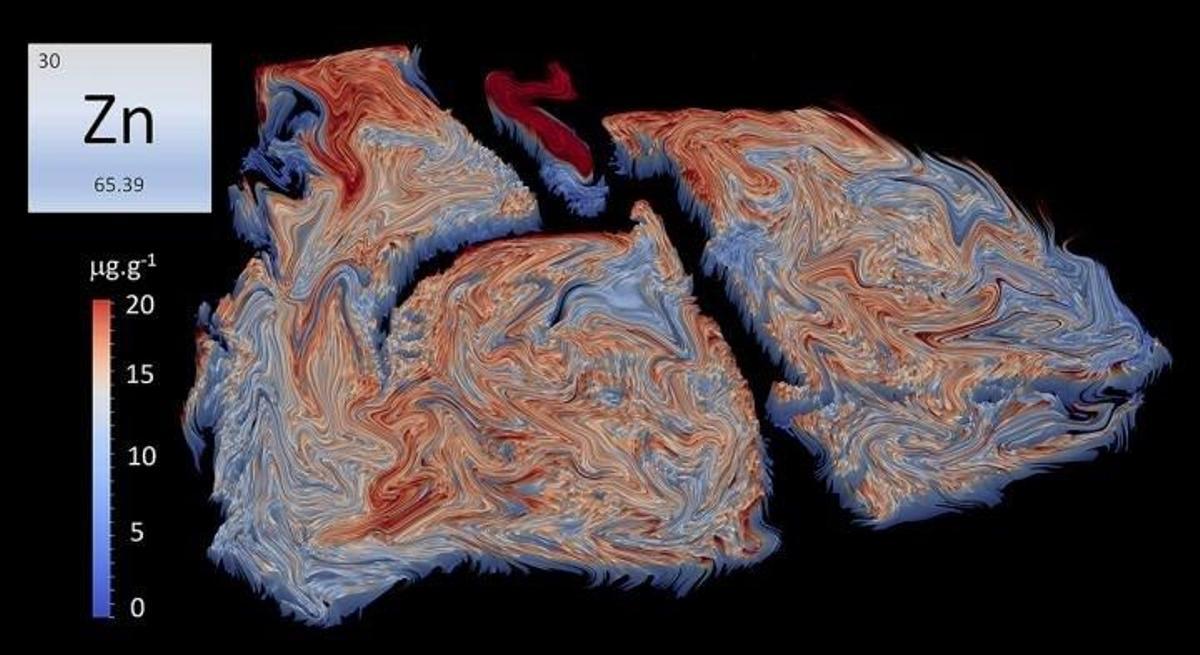 Archivo - Estas son bioimágenes elementales de pulmones de ratón durante la infección por Streptococcus pneumoniae . La imagen muestra niveles elevados de zinc (regiones naranja a rojo) movilizados por la respuesta inmune innata a los sitios donde la bact