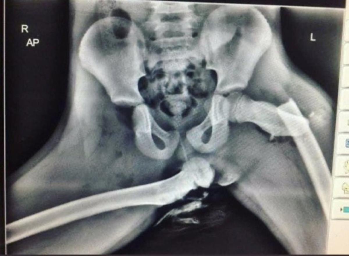 Mira esta radiografía antes de viajar con los pies en el salpicadero