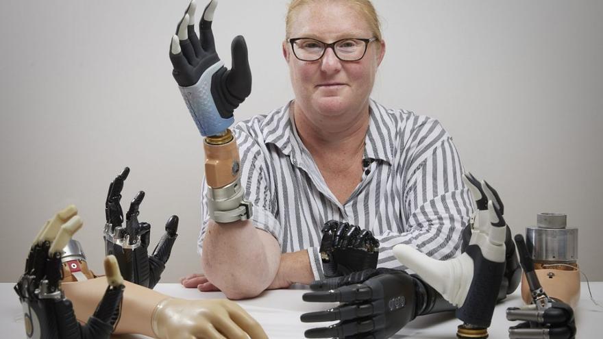 Una revolucionaria mano biónica se fusiona directamente con el cuerpo humano