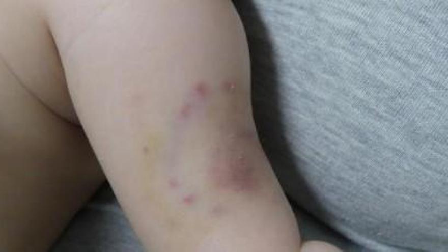 Detenen els pares d&#039;un nadó de dos mesos a Mallorca per clavar-li mossegades